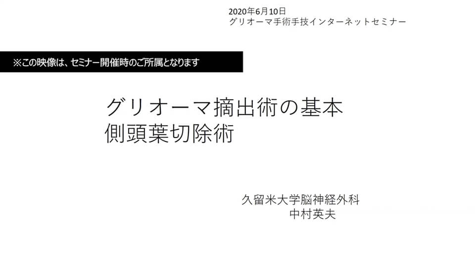 2. グリオーマ摘出術の基本 側頭葉切除術