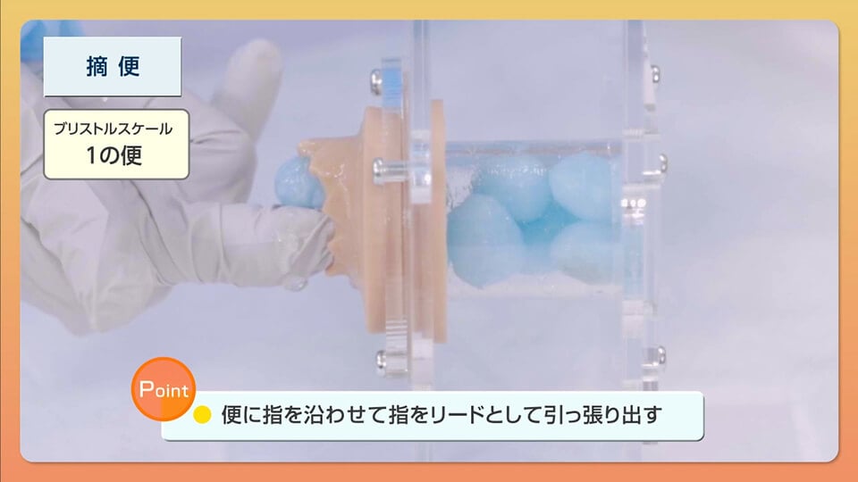 continence-care06_02