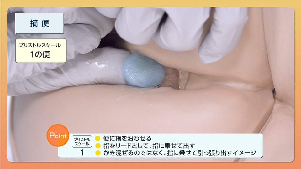 continence-care06_03