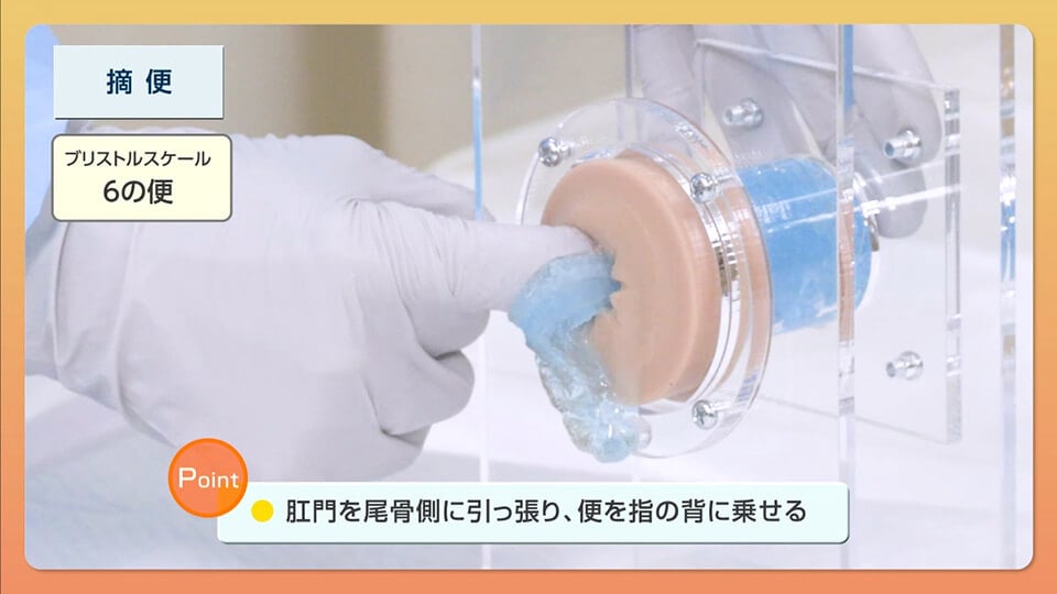 continence-care06_05