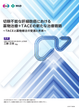 切除不能な肝細胞癌における 薬物治療＋TACEの新たな治療戦略（LEN1719）