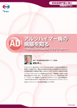 アルツハイマー病の病態を知る ～ AD Continuumとバイオマーカー～（LEQ1027）